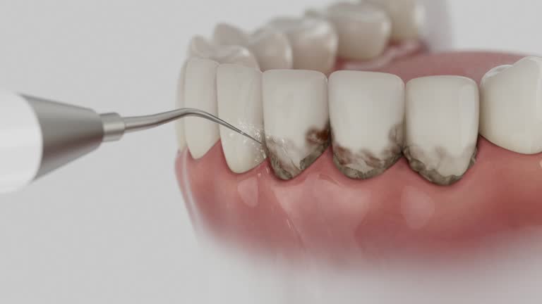 Trusted Teeth Cleaning And Checkup service in Roseland, LA - Dentist Open Now